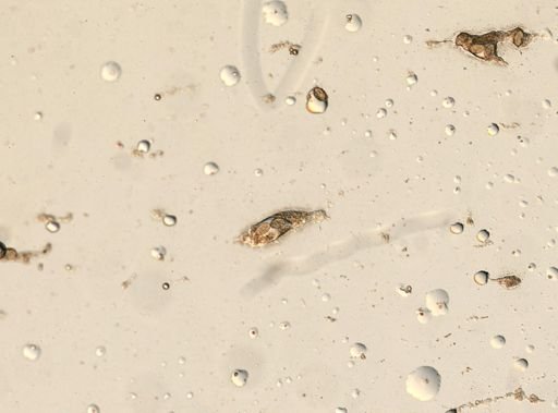 Diphyllobothrium canis