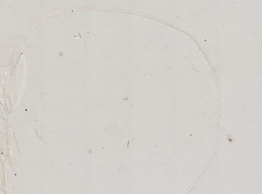 Paramecium polycaryum