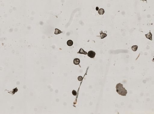 Radiolaria
