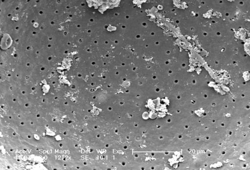 Globigerina bulloides