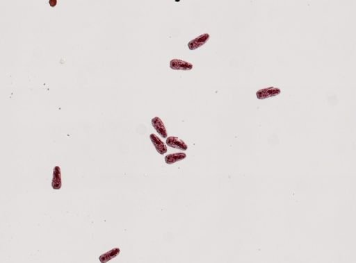 Fasciola hepatica