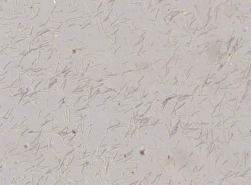 Cribrochalina vasculum