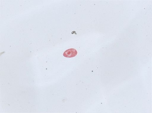 Paramecium aurelia