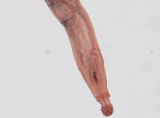 Oligacanthorhynchus microcephalus