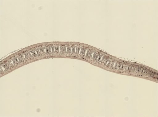Turbellaria