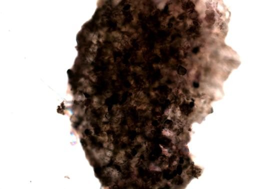 Bryozoa