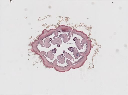 Edwardsia sp.