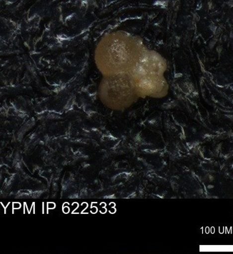 undet. Rugoglobigerinidae
