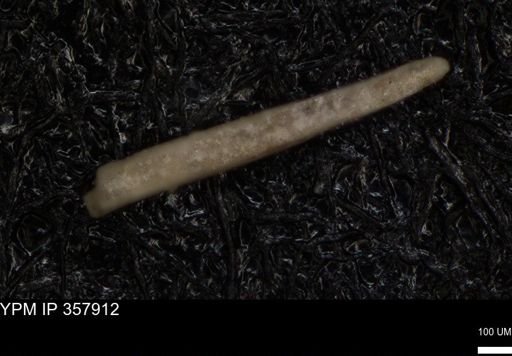 undet. Echinoidea