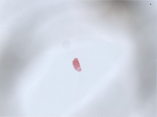 Woodruffia metabolica