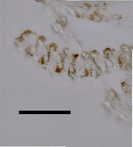 Apolemia lanosa