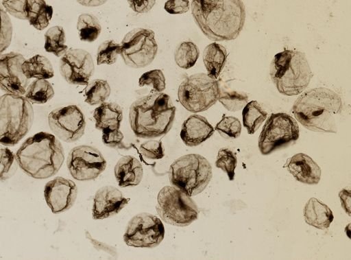 Noctiluca
