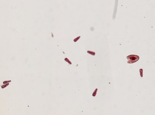 Fasciola hepatica