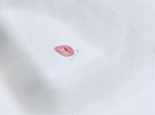 Paramecium aurelia