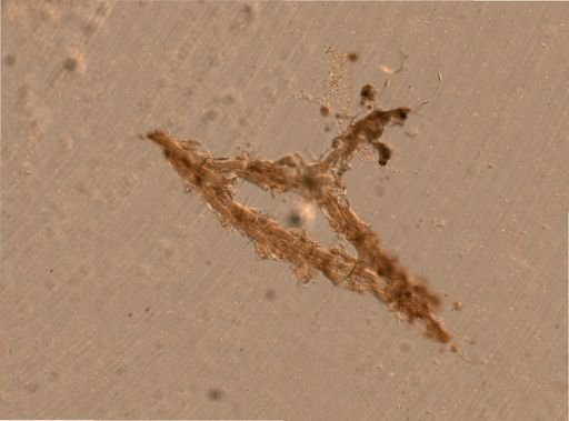 Bryozoa