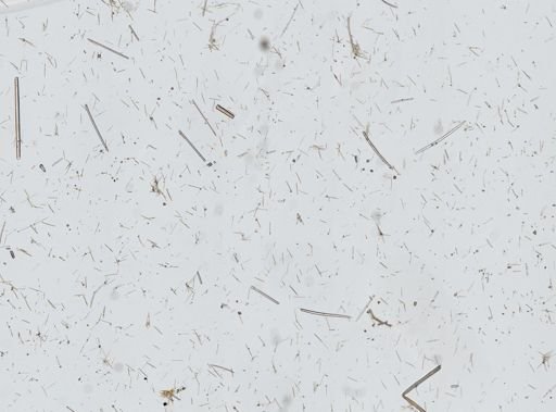 Callyspongia vaginalis