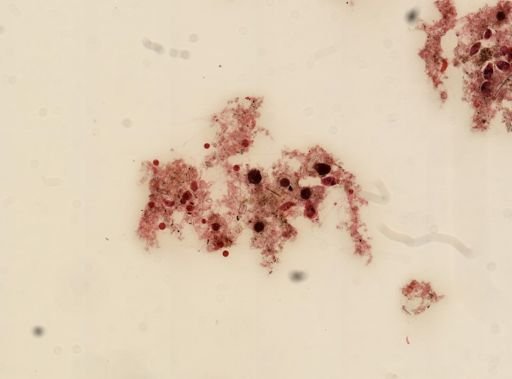 Vorticella