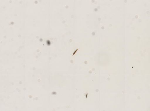 Paramecium