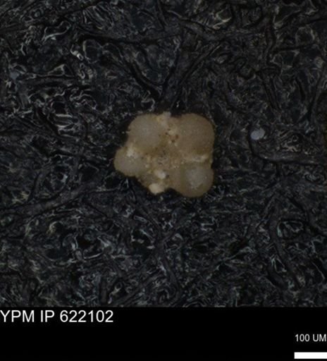 undet. Rugoglobigerinidae