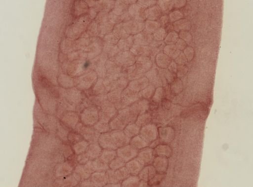 Dipylidium caninum