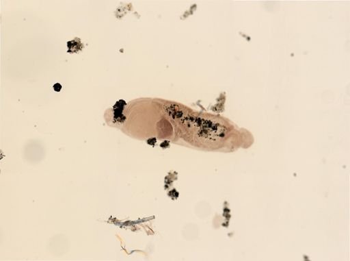 Dinophilus gyrociliatus