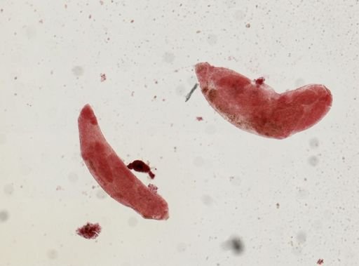 Fasciola hepatica