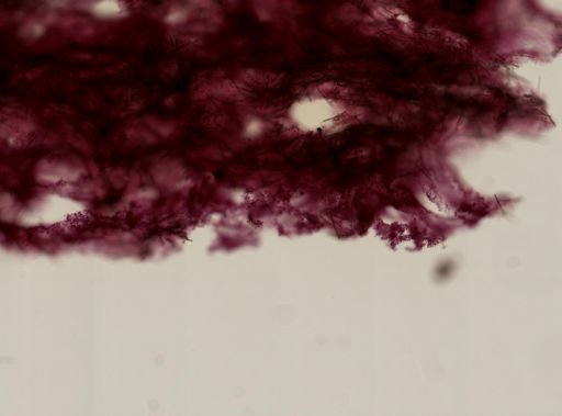 Lissodendoryx noxiosa