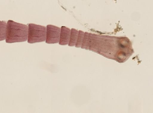 Dipylidium caninum