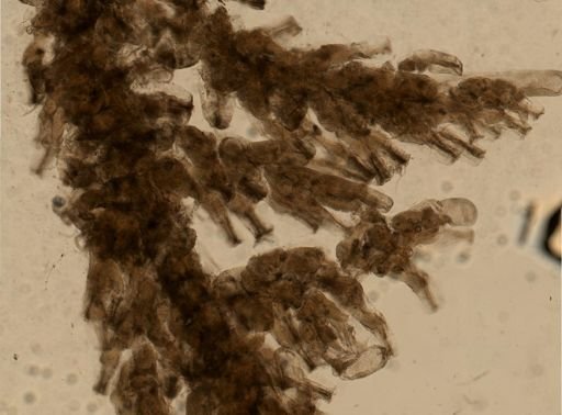 Bryozoa