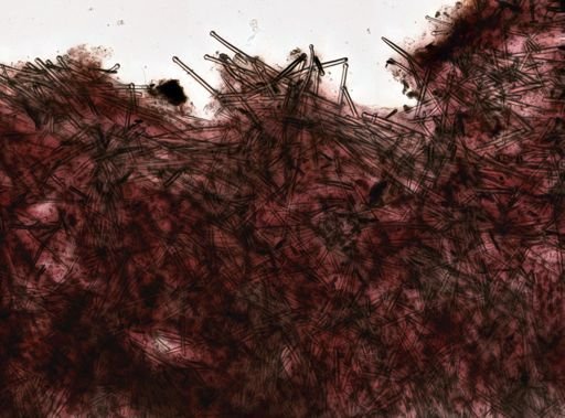 Suberites sp.