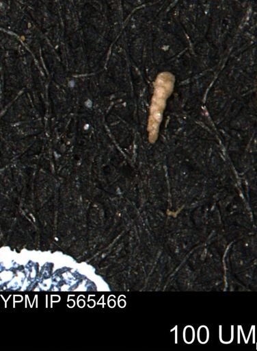 Verneuilina canadensis
