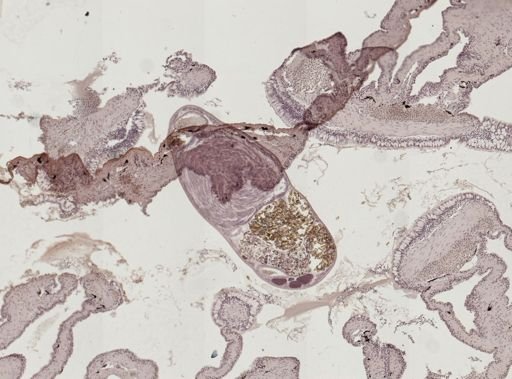 Haematoloechus