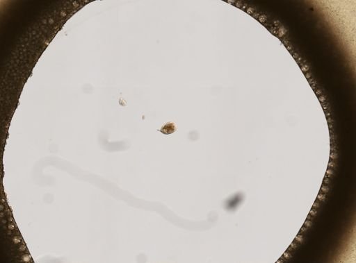 Lecane spinulifera