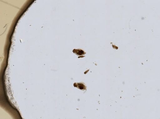 Rotifera