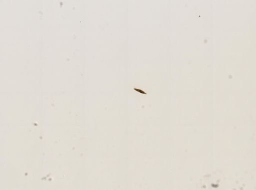 Paramecium