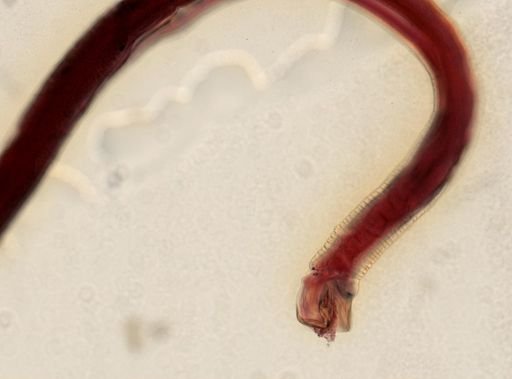 Hedruris chandleri