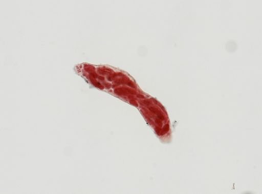 Digenea