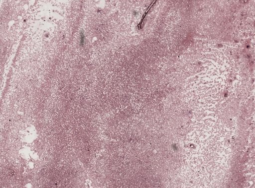 Trypanosoma lewisi
