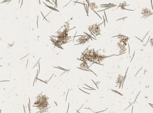 Spongilla fragilis