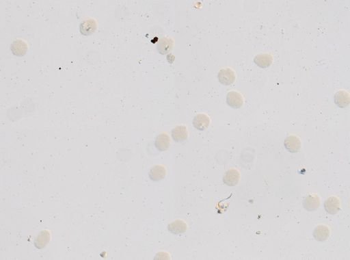 Toxocara cati