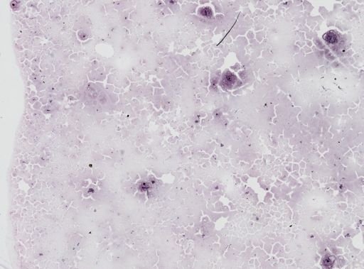 Leishmania donovani