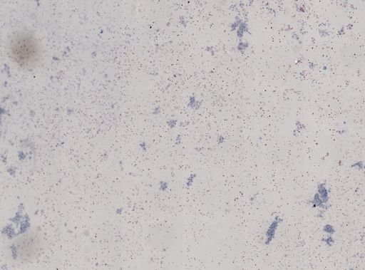 Trypanosoma?