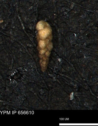 Verneuilina canadensis