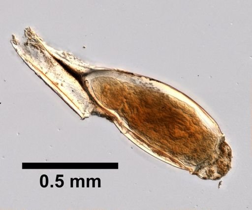 Pthirus pubis