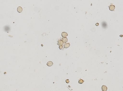 Diphyllobothrium latum