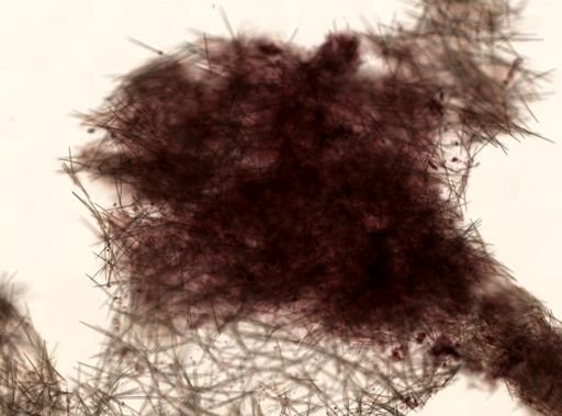 Halichondria bowerbanki