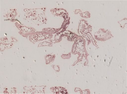 Holothuria tubulosa