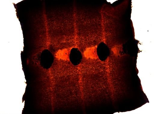 Diphyllobothrium erinacei