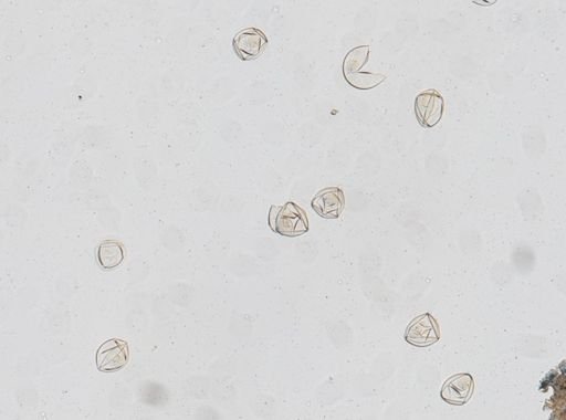 Hymenolepis diminuta