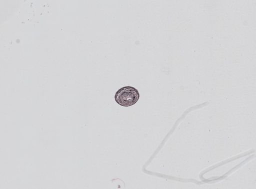 Plagiostomum whitmani